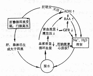 肝硬变时腹水发生发展综合机制示意图