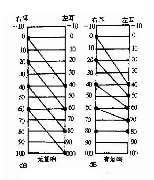 响度平衡试验