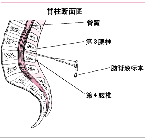 脊柱断面图