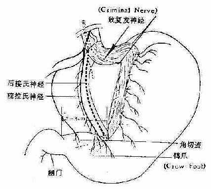 高选迷切示意图