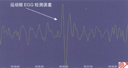 EGG记录到的误差