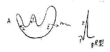 A正常心室除极、在左室外膜电极示qR型波群