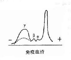 兔血清电泳分离图