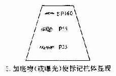 免疫印迹法检查患者血清中的HIV病毒抗体