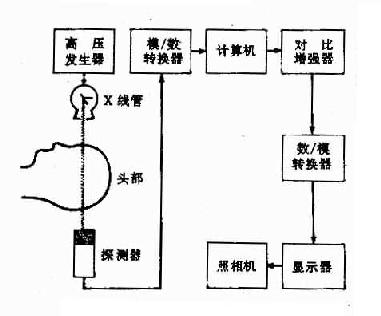 CT装置示意图