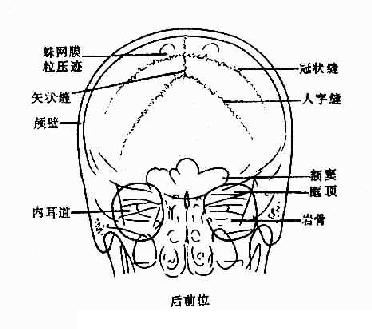 正常颅骨